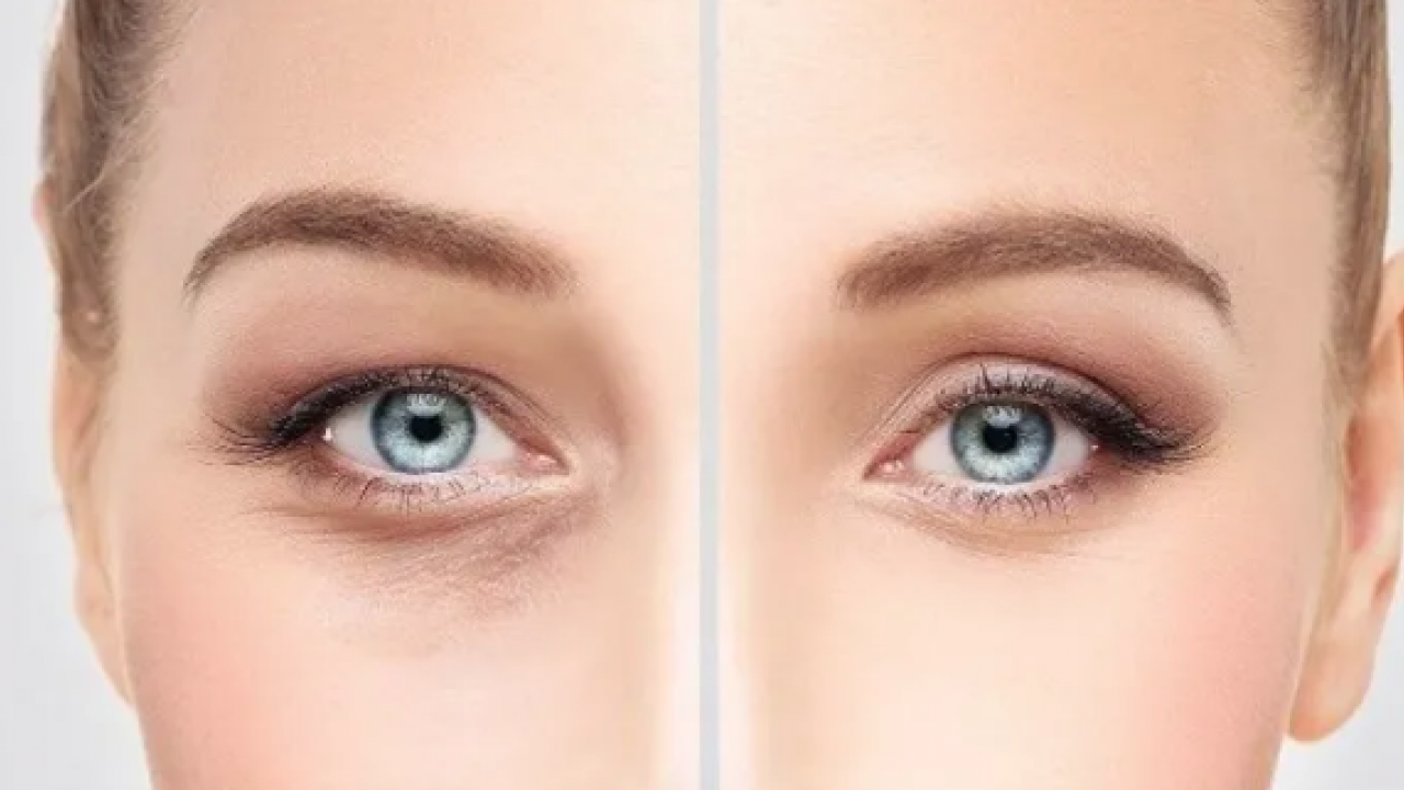 Makyajsız aydınlık göz çevresi: 3 sabah rutini ile cildin doğal nem dengesini korumanın doğal yolları bulundu!