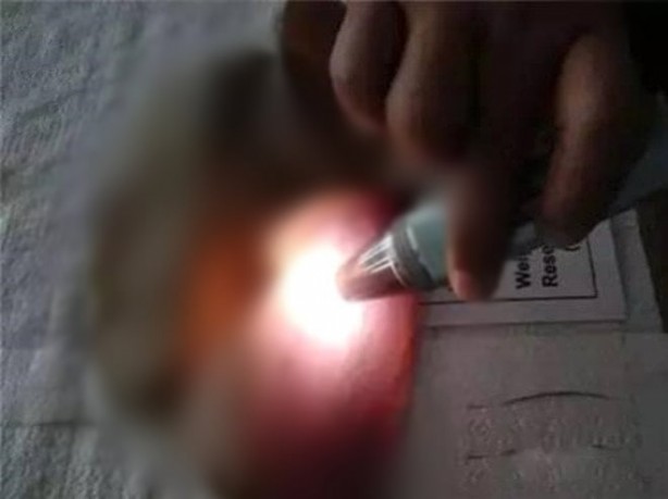Mantar toplarken büyük hazine buldu! Sadece bir gramı 5 bin TL! Üst kısmını soyunca bakın ne çıktı