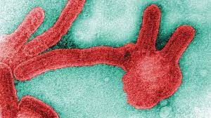 Foto - Marburg virüsü tehlikesi! Bulaştığını 9 gün sonra kan kaybından öldürüyor!