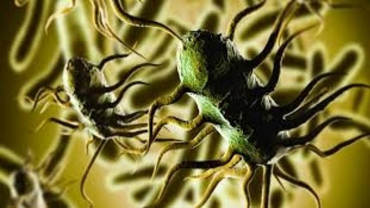 Foto - Marketlerde satılıyordu, o üründe ölümcül bakteri tespit edildi! Alanlar bin pişman! Acilen raflardan toplatılıyor