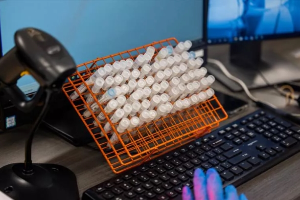 Maymun çiçeği nasıl tespit ediliyor? Aşama Aşama görüntülendi