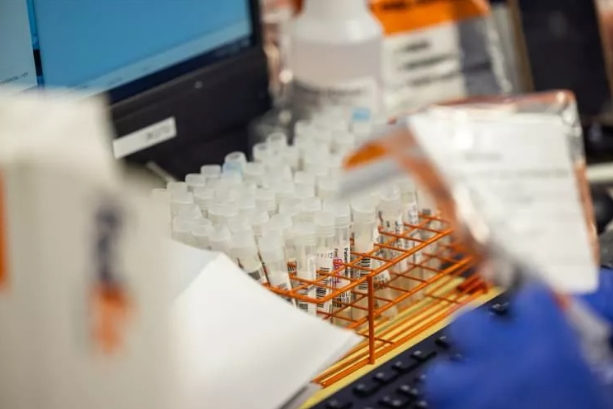 Foto - Maymun çiçeği nasıl tespit ediliyor? Aşama Aşama görüntülendi