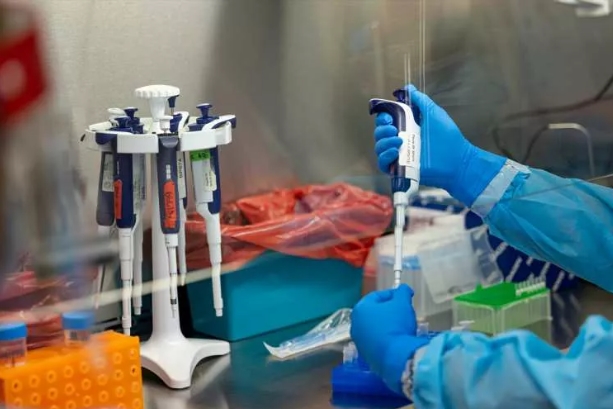 Foto - Maymun çiçeği nasıl tespit ediliyor? Aşama Aşama görüntülendi