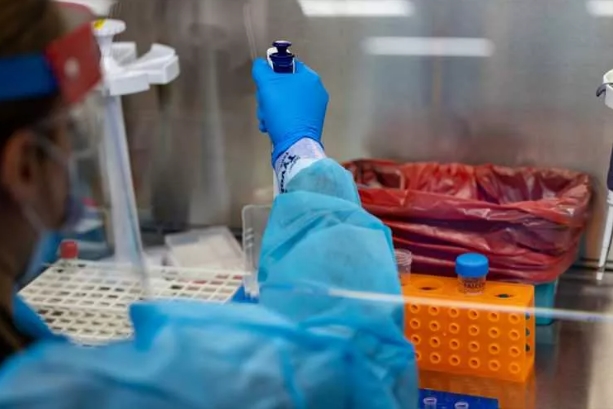 Foto - Maymun çiçeği nasıl tespit ediliyor? Aşama Aşama görüntülendi