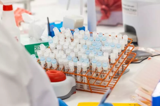 Foto - Maymun çiçeği nasıl tespit ediliyor? Aşama Aşama görüntülendi