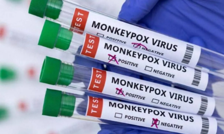 Foto - Maymun çiçeği virüsü bakın nasıl bulaşıyormuş! 30 dakika biriyle aynı odada...