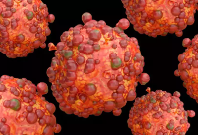 Foto - Maymun çiçeği virüsü bakın nasıl bulaşıyormuş! 30 dakika biriyle aynı odada...