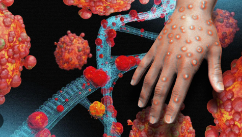 Maymun çiçeği virüsü bakın nasıl bulaşıyormuş! 30 dakika biriyle aynı odada...