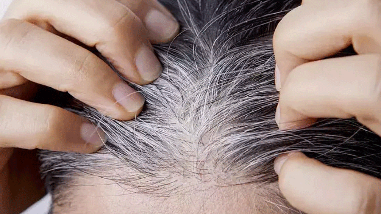 Foto - Meğer vitamin eksikliğinden oluyormuş! Harvardlı uzmanlardan ezber bozan araştırma!