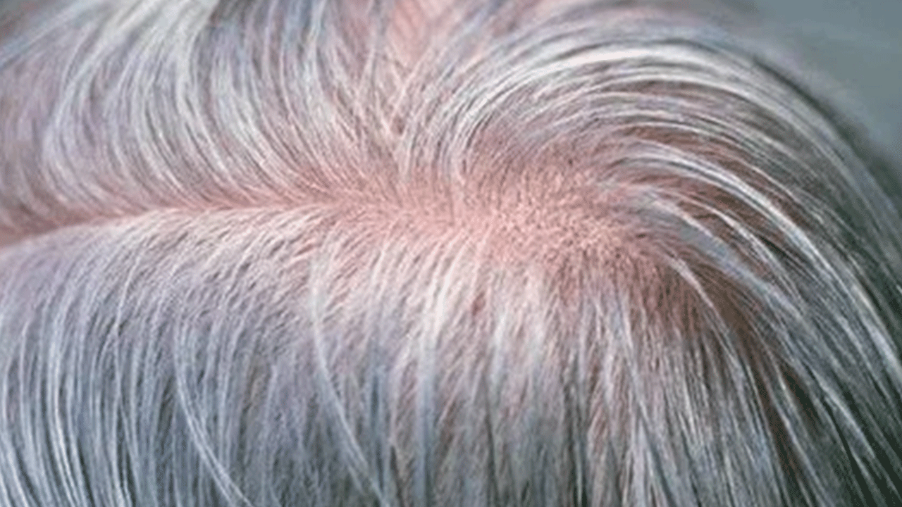 Foto - Meğer vitamin eksikliğinden oluyormuş! Harvardlı uzmanlardan ezber bozan araştırma!