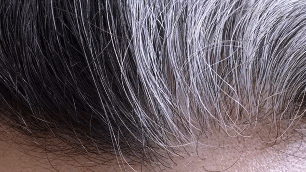 Foto - Meğer vitamin eksikliğinden oluyormuş! Harvardlı uzmanlardan ezber bozan araştırma!