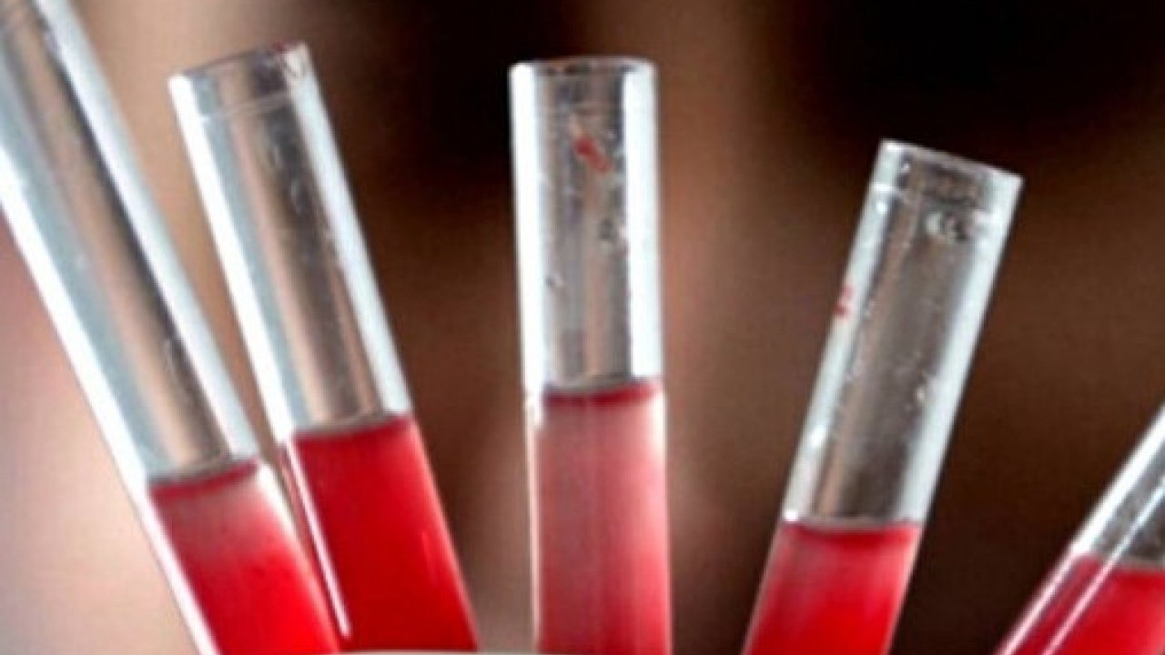 Foto - Japon bilim adamları açıkladı: İşte kan gurubunuza göre ideal meslekler!