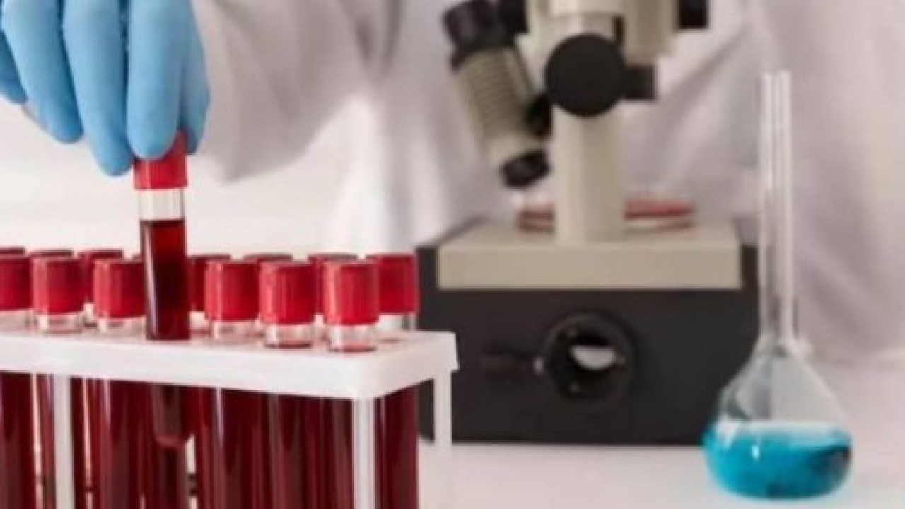 Foto - Japon bilim adamları açıkladı: İşte kan gurubunuza göre ideal meslekler!