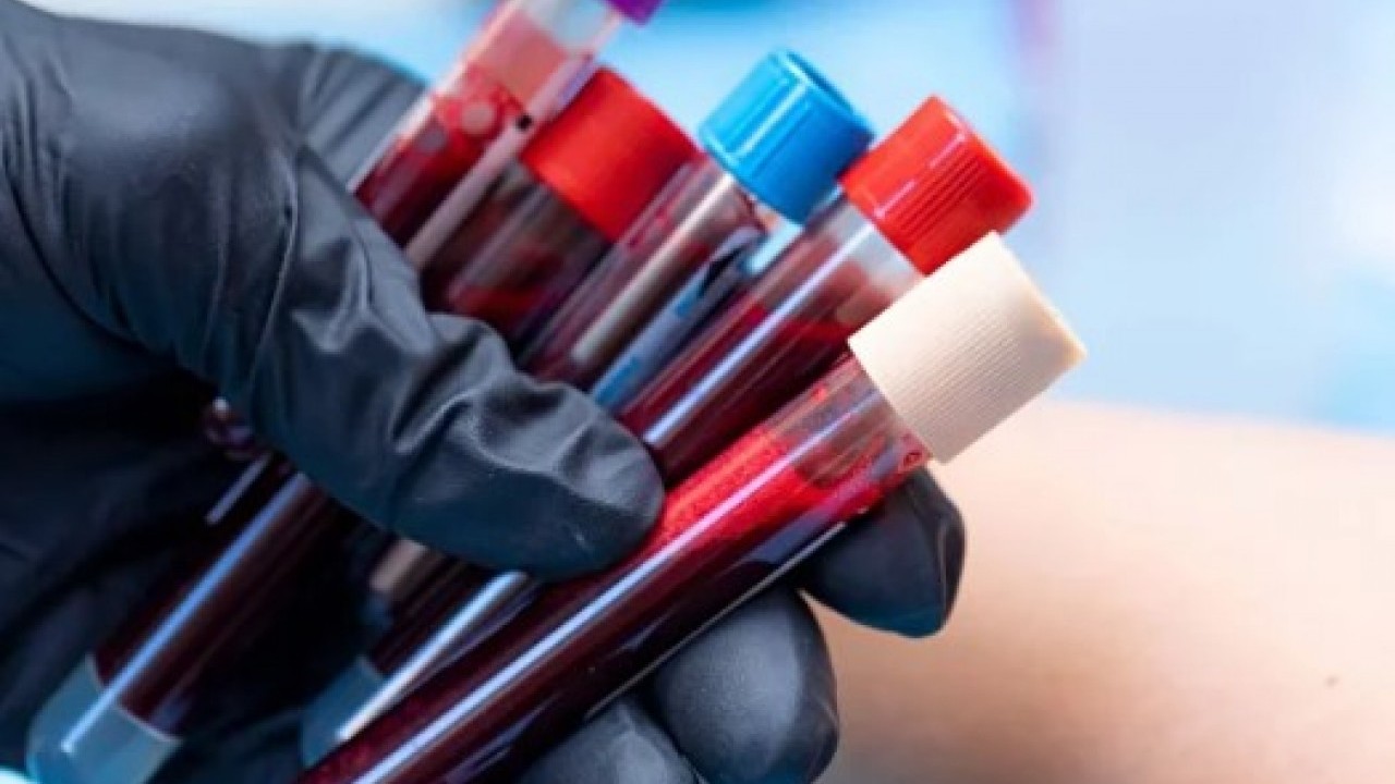 Foto - Japon bilim adamları açıkladı: İşte kan gurubunuza göre ideal meslekler!