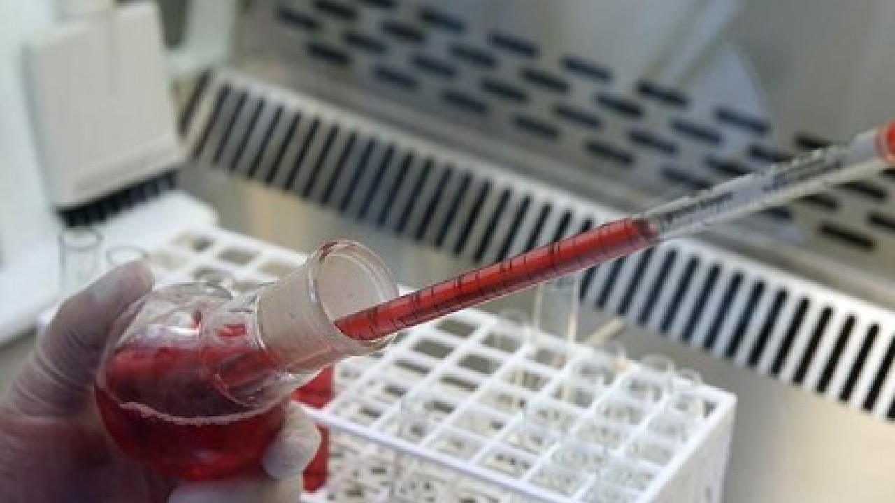 Foto - Japon bilim adamları açıkladı: İşte kan gurubunuza göre ideal meslekler!