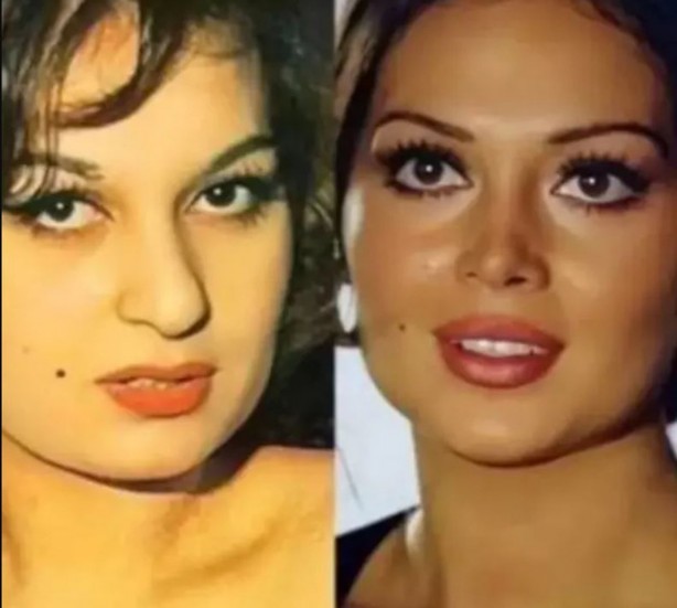 Foto - Meğer Türkan Şoray da estetik harikasıymış... Estetiksiz halini görenler "Yok artık" dedi! Gözlerinize inanamayacaksınız