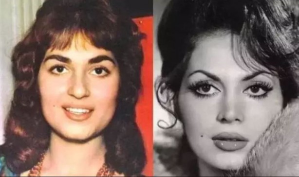 Foto - Meğer Türkan Şoray da estetik harikasıymış... Estetiksiz halini görenler "Yok artık" dedi! Gözlerinize inanamayacaksınız