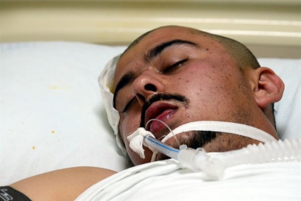 Foto - Merminin balistik incelenmesinin yapılması için kafasından çıkarılması gerek