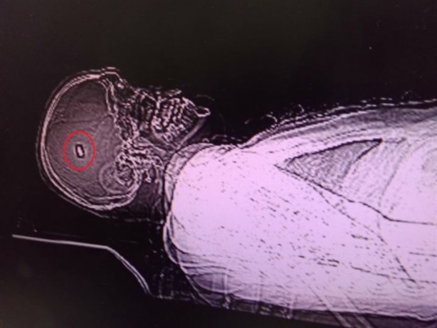 Foto - Merminin balistik incelenmesinin yapılması için kafasından çıkarılması gerek