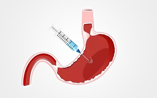 Foto - Mide botoksu ile ilgili 5 soru 5 cevap