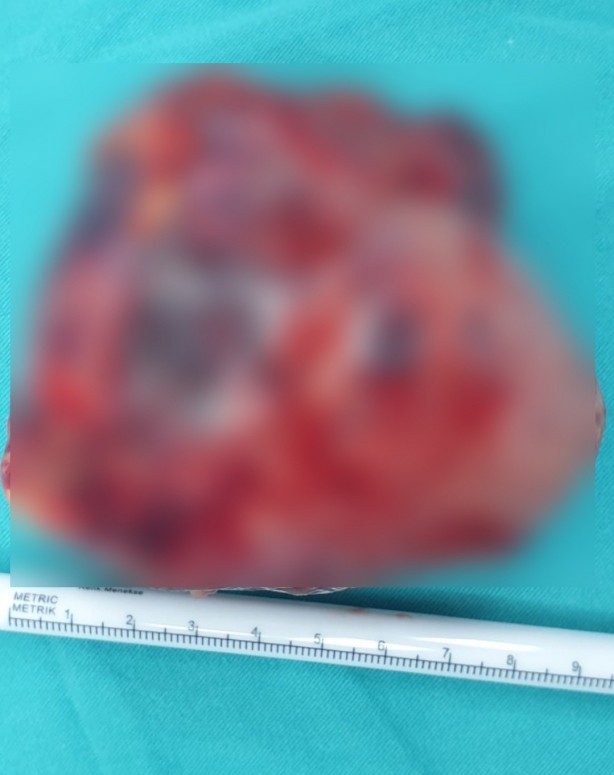 Foto - Mide bulantısı şikayeti ile hastaneye giden 14 yaşındaki kıza büyük şok!