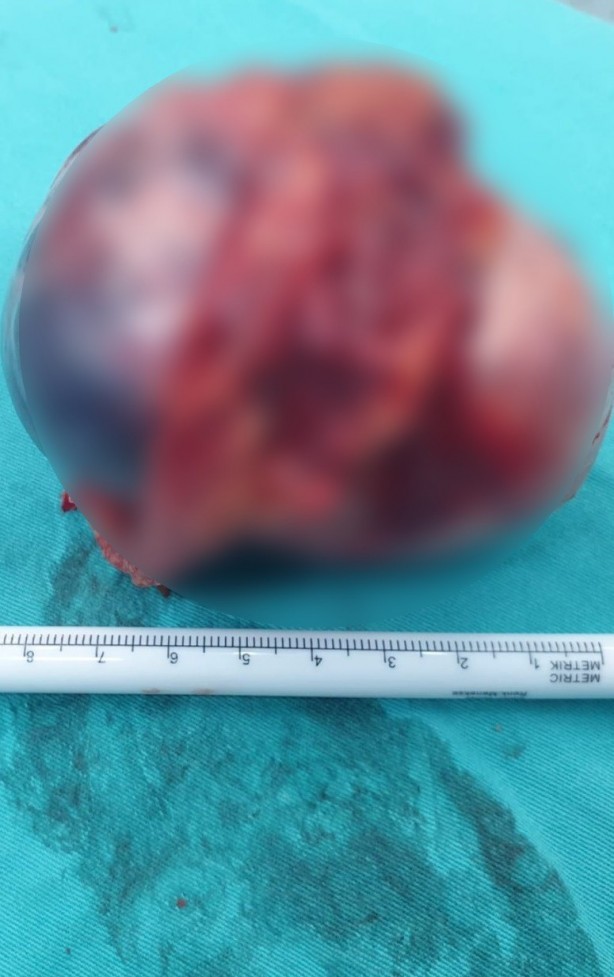 Foto - Mide bulantısı şikayeti ile hastaneye giden 14 yaşındaki kıza büyük şok!