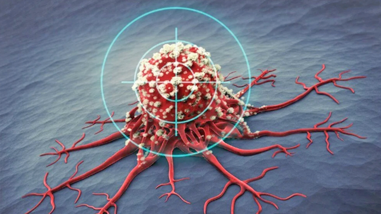 Foto - Mide kanseri iyileşir mi?.. Nasıl teşhis edilir?.. Mide kanserinin erken belirtisinde 8 işaret hayati önem taşıyor