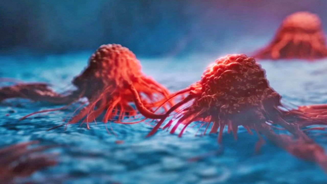 Foto - Mide kanseri iyileşir mi?.. Nasıl teşhis edilir?.. Mide kanserinin erken belirtisinde 8 işaret hayati önem taşıyor