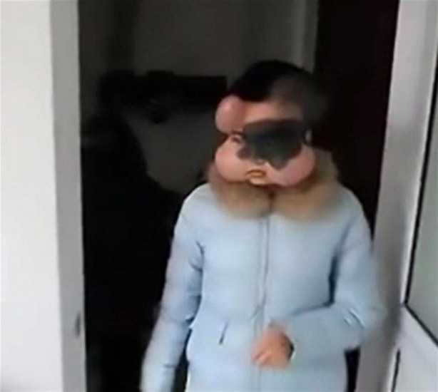 Foto - İşte Dünyanın en garip hastalıkları