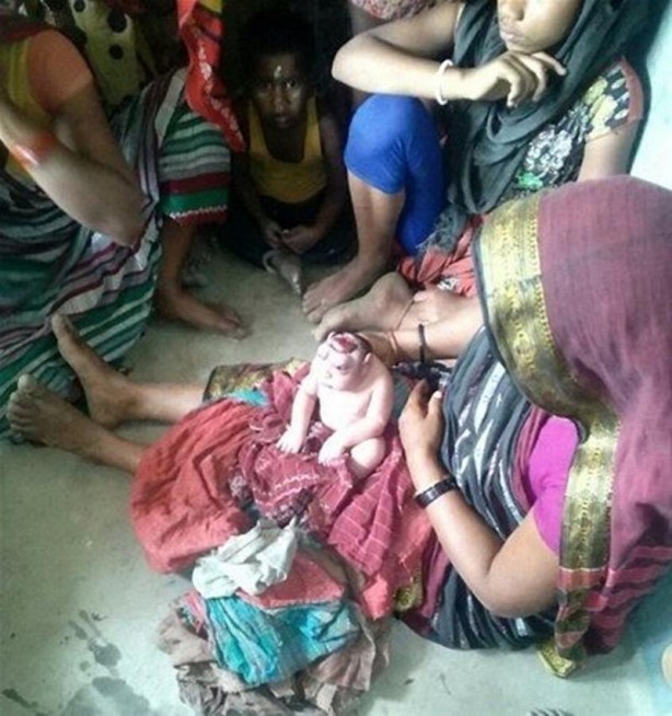 Foto - İşte Dünyanın en garip hastalıkları