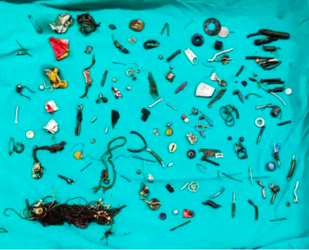 Foto - Midesinden çıkanlarla sergi açılır! Öyle şeyler çıktı ki doktorlar bile şaştı kaldı