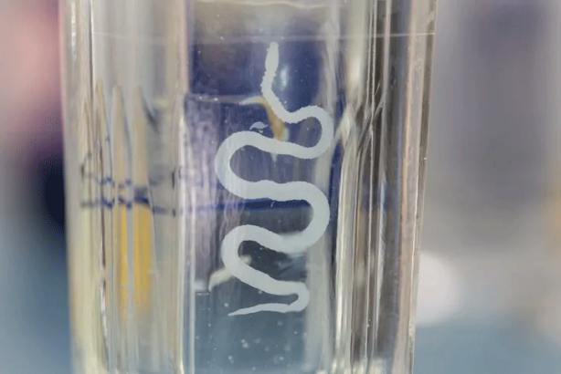 Foto - Migren ağrısı diye gitti beyninden larva çıktı! O yiyecek kabusu oldu…