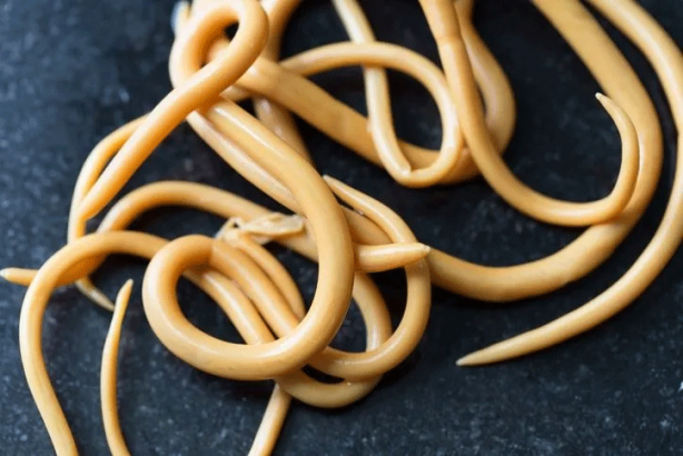 Foto - Migren ağrısı diye gitti beyninden larva çıktı! O yiyecek kabusu oldu…