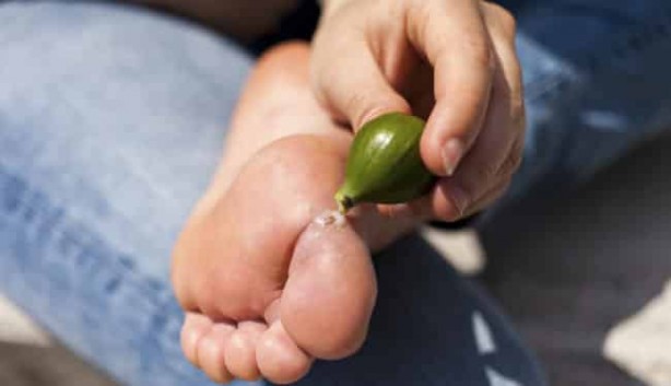 Foto - Mikropları yok edip yaraları iyileştiriyor