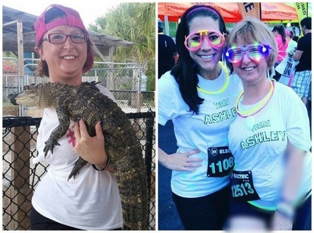 Foto - Milyonda bir görülen hastalık: Kemikleri yok oluyor!