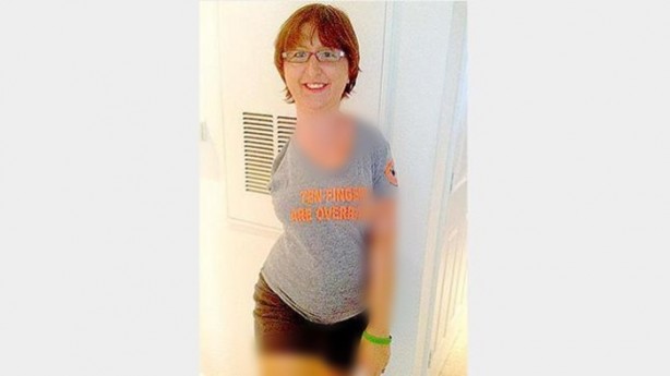 Foto - Milyonda bir görülen hastalık: Kemikleri yok oluyor!