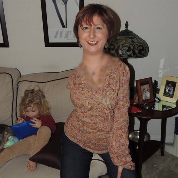 Foto - Milyonda bir görülen hastalık: Kemikleri yok oluyor!