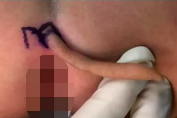 Foto - Milyonda bir görünüyor, doktorlar bile donup kaldı! Böyle bir şey nasıl olur?