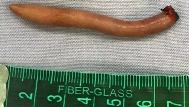 Foto - Milyonda bir görünüyor, doktorlar bile donup kaldı! Böyle bir şey nasıl olur?