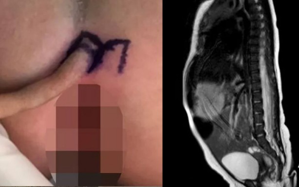 Milyonda bir görünüyor, doktorlar bile donup kaldı! Böyle bir şey nasıl olur?