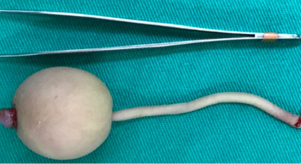 Foto - Milyonda bir görünüyor, doktorlar bile donup kaldı! Böyle bir şey nasıl olur?