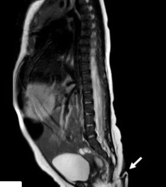 Foto - Milyonda bir görünüyor, doktorlar bile donup kaldı! Böyle bir şey nasıl olur?