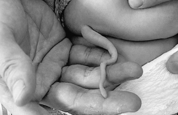 Foto - Milyonda bir görünüyor, doktorlar bile donup kaldı! Böyle bir şey nasıl olur?