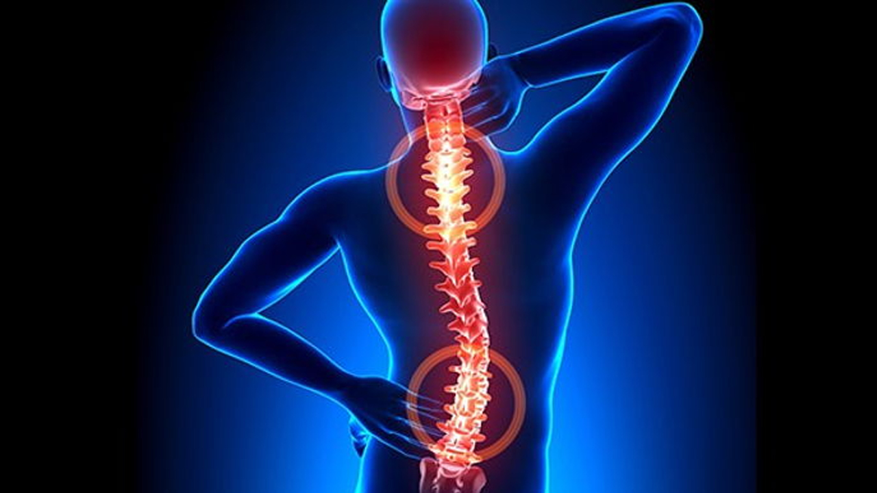 Milyonlarca insan bu rahatsızlığı yaşıyor! Boyun ve sırt ağrısından kurtulmanın 5 yolu