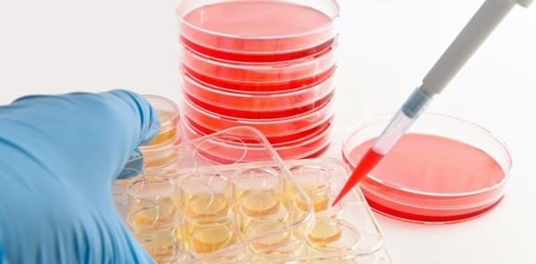 Foto - MS hastalığı tedavisinde büyük gelişme!