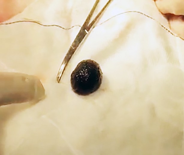 Foto - Muayene sonrası inanılmaz bulgu! Doktor bile şaşkına döndü