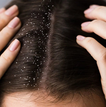 Foto - Mutfağınızdaki bu ürün sayesinde kepek sorunu tarihe karışıyor! Mucizevi bir şey! Uygulayanlar, dua edecek