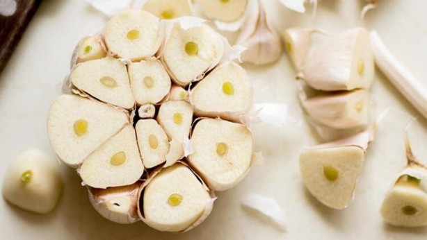 Foto - Muz ile kabuğu arasındaki ince lifleri atanlar dikkat!