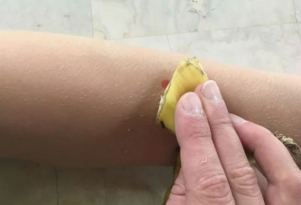 Foto - Muz kabuğunu çöpe atmayın! Bu zamana kadar attıklarınız için pişman olacaksınız, bakın nelere faydalı