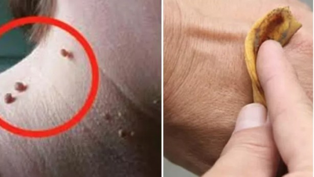 Foto - Muz kabuğunu çöpe atmayın! Bu zamana kadar attıklarınız için pişman olacaksınız, bakın nelere faydalı